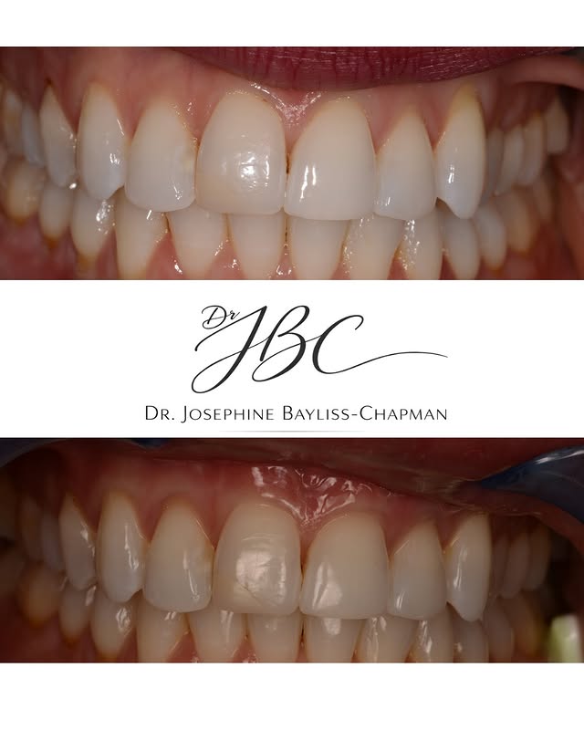 Clinical case from Dr JBC's Instagram